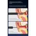 Ear Wax Removal Tool Ear Cleaner with 3 Ear Cleaning Kits Black White Black - Buy Online on GoSupps.com