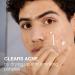 Neutrogena Stubborn Acne Spot Drying Lotion - Fragrance-Free 10% Sulfur Acne Treatment Paraben & Oil-Free 1 fl. oz - Clears & Shrinks Pimples - Buy Online on GoSupps.com