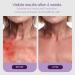 KOKOBAL PureCalm Anti-Itch Serum - Organic Skin Relief for Irritation Inflammation & Dryness | Hydrating Serum for Acne Sunburn & Sensitive Skin | 4 Oz - Buy Online on GoSupps.com