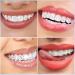 Leelosp 480 Pcs Tooth Gem Kit DIY Teeth Crystals Jewelry Fashionable Teeth Gems Kit Artificial Crystal Tooth Reflective Ornaments (Without Glue) (White) - Buy Online on GoSupps.com