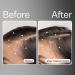 Act+Acre Apple Stem Cell Scalp Serum - Promotes Growth, Lessens Hair Loss, Soothes & Hydrates - Sulphate & Paraben Free - With Aloe Vera - Buy Online on GoSupps.com