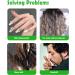 Sivlki Scalp Massage Brush | Silicone Shampoo Brush for Dandruff & Hair Growth | Stimulate Scalp & Enhance Peeling Relief - Buy Online on GoSupps.com