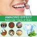 Teeth Whitening Pen Kit (4PCS) - Painless & Effective Whitener for Sensitive Teeth | Travel-Friendly Gel Pen - Buy Online on GoSupps.com
