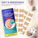 Ingrown Toenail Treatment - Painless Corrector Strips & Nail Correction Patches | 100 Pcs - Buy Online on GoSupps.com