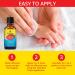 Molluscum Contagiosum Treatment - Fast, Safe, Painless All Natural Solution for Children and Adults - 15mL - 1 Month Supply - Buy Online on GoSupps.com