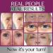NEW Immaculift Instant Eye Tightener - Best Eye Cream for Dark Circles & Puffy Eyes - Under Eye Bags Treatment for Men & Women - DERMAWORKS Eye Lift & Tightening Cream - Buy Online on GoSupps.com