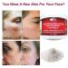 Clear Alka Vita Acne Scars Gel - Silicon & Collagen Crystals for Atrophic & Keloid Scars - 4.0 Fl Oz - Buy Online on GoSupps.com