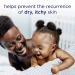 Dove Baby Eczema Care Soothing Cream 5.1 oz | Gentle Relief for Baby's Skin - Buy Online on GoSupps.com