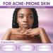 Azelaic Acid Face Cream + Butt & Back Acne Lotion Bundle Complete Face & Body Acne Care with Azelaic Acid Salicylic Acid & Niacinamide Helps Reduce Breakouts Bumps & Clogged Pores for Women Men - Buy Online on GoSupps.com