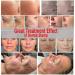 CLETINA Adjustable Microneedling Derma Stemp Pen - 140 Titanium 0.25mm Pins for Face, Body, Skin, Hair & Beard Growth - Buy Online on GoSupps.com