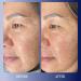 Buy Kinship Dreamwave 2% Bio-Retinoid Overnight Renewal Serum - Anti-Aging for Sensitive Skin Smooth Wrinkles & Brighten Complexion - 1 Oz | Free International Shipping - Buy Online on GoSupps.com