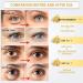 30 Pairs Eye Pads - Anti-Aging Dark Circle Treatment with Hyaluronic Acid | Reduce Puffiness & Eye Bags - Buy Online on GoSupps.com