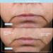 NuFACE TRINITY+ Starter Kit: Microcurrent Facial Toning Device with Aqua Gel & Silk Cr me Activators - Buy Online on GoSupps.com