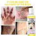 Yellow Peeling Oil - Extra Strength Chemical Peel for Dark Skin & All Skin Types | Exfoliating Solution 1 Bottle - Buy Online on GoSupps.com