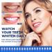 Celakeety Teeth Whitening Kit: Pap Teeth Whitener for Sensitive Teeth- Professional Tooth Whitening Kit Dental Tools with Mouth Tray 6 Teeth Whitening Gels 2 Desensitizing Gels and Storage Case - Buy Online on GoSupps.com