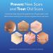 ScarAway Scar Diminishing Gel 10g - Reduce Scars Effectively - Buy Online on GoSupps.com