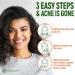 GRAMRIGHT Acne Patches - Natural Hydrocolloid Bandages for Acne Spot Treatment with Salicylic Acid, Hyaluronic Acid, Tea Tree Oil - 120 Pimple Patches - Buy Online on GoSupps.com