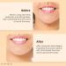 LILYFIELD Wrinkle Correcting Serum - Phyto Collagen & Vitamin C Anti-Aging Dark Spot Targeting | Korean Skincare for All Skin Types - 30ml - Buy Online on GoSupps.com