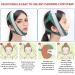 Adjustable Anti-Snoring Chin Strap for Women - Stop Snoring with NXKIDR Chin Strap for Sleeping - Buy Online on GoSupps.com