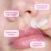 Buy Anti Scarring Patches (48 Patches) | Dermatologist-Approved Acne Pimple Treatment | Minimize Scars & See Results in 6 Hours | International Shipping Available - Buy Online on GoSupps.com