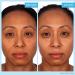 SKINN Luminous Firming Cream - Improve Elasticity, Lift Sagging Skin | Hydrating Vitamin C Formula - Buy Online on GoSupps.com