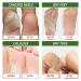 Tea Tree Oil Foot Care Set for Damaged Nails, Itchy Skin, Athlete's Foot, Smelly Feet - Made in USA - Buy Online on GoSupps.com