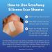 ScarAway Advanced Silicone Scar Sheets - Medical Grade Treatment for Surgical, Burn, Acne & Body Scars - 4 Tan Reusable Strips - Buy Online on GoSupps.com