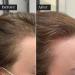 Hair Growth Oil | Daily Hair Care Treatment Hair Oil Care 5ml x 3 Set of Plant-Based Hair Growth Oil Moisturizing Nourishing the Scalp Contains - Buy Online on GoSupps.com