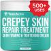 TreeActiv Crepey Skin Repair Treatment | Hyaluronic Acid Skin Firming & Tightening Lotion for Sagging Neck, Arms, Chest, & Legs | Anti-Aging & Anti-Wrinkle Cream & Stretch Marks Remover | 500+ Uses