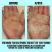 Peace Out Pores Hydrocolloid Nose & Face Strips with Vitamin A - Enlarged Pore Refining & Oil Control (4 Pore & 4 Nose Strips) - Buy Online on GoSupps.com