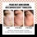 Peace Out Skincare Acne Serum - 2% Salicylic Acid for Clear Skin | Daily Multi-Benefit Face Serum | International Shipping Available - Buy Online on GoSupps.com