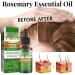 Rosemary Oil For Hair Growth Pure Natural Rosemary essential Oil Nourishing Scalp & Hair Strengthening Oil Stimulates & Strengthens Hair Growth Oil 30 ML Rosemary Hair Oil - Buy Online on GoSupps.com