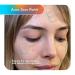 Fazit Acne Scar Treatment Patches - 24 Individual Patches for Face Bikini & Body - Effective Acne Scar Remover - Buy Online on GoSupps.com