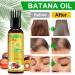 Batana Oil for Hair Growth 120ml Raw Batana Oil Organic from Honduras - for Thicker & Stronger Hair Scalp and Hair Oil Men & Women All Hair Types - Buy Online on GoSupps.com