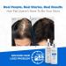 Follicle Stem Cell Serum with Redensyl, Capixyl, HairSpa - 1.7 fl oz - Hair Growth & Scalp Treatment - Buy Online on GoSupps.com