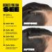 Babe Original Locks Densifying Hair Serum | Promotes Thickness in Thinning Hair for Men & Women | Hair Loss Treatment - Buy Online on GoSupps.com