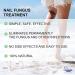 Podocure Anti-fungal Solution | With Undecylenic Acid 25% | 30ml | Finger and Toe Fungus Treatment Nail and Athlete Repair Solution Treats Onychomycosis Treats Fungal Infections | 100% Natural | Podiatric Laboratory in CANADA | (PACK OF 1) - Buy Online on GoSupps.com
