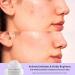 Alpyn Wild Huckleberry Recovery Peel - Exfoliate Moisturize & Soothe Skin | Reduce Redness | 1.7 oz / 50 ml - International Shipping Available - Buy Online on GoSupps.com