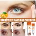 Vitamin E Eye Serum Eye Creams Eye Cream Anti-Aging Under Eye Cream for Dark Circles Puffy Eyes Moisturising Eye Cream Prevents Under Eye Bags Fatigue for Wrinkles and Fine Lines - Buy Online on GoSupps.com