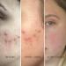 REFLEKT 2 Collagen Boost Vitamin C Serum - Enhance Your Skin's Radiance International Shipping Available - Buy Online on GoSupps.com