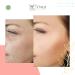 Buy Y-Not Natural Australian Emu Oil with Vitamin E & C - 50mL Skin Brightener Serum for Face & Body | Reduce Aging Spots & Sun Damage | Antioxidant with Omega 3 6 9 & Essential Oils - Buy Online on GoSupps.com