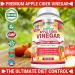 Premium Apple Cider Vinegar Capsules 1740mg with Mother - Natural & Raw with Cinnamon, Ginger & Cayenne - 120 Vegan Pills for Detox & Digestion - Buy Online on GoSupps.com