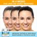 Anti Aging Collagen & Retinol Face Cream with Hyaluronic Acid - 1.7 Fl Oz - Buy Online on GoSupps.com