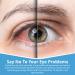 Vision Clarity Eye Drops 1% Carnosine - Antioxidant Lubricants for Dry Eyes & Cataracts - 2 Vials x 5ml - Buy Online on GoSupps.com