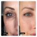 Geologie Dark & Puffy Under Eye Cream | Fight Dark Circles & Puffiness | 10 ML Daily Eye Cream with Kojic Acid, Caffeine & Hyaluronic Acid | 90 Day Supply | 1 Count - Buy Online on GoSupps.com