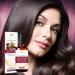 Natural Hair Growth Oil - Formula with Nourishing Jojoba Oil Strengthening for Fine and Weak Hair | Moisturizing Anti-Frizz Treatment 30ml to Boost Density and - Buy Online on GoSupps.com