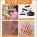 20 Pack Finger Protectors Finger Cots Moisturizing Thumb and Finger Covers Elastic Cracked Finger Sleeves to Protect Cracked Peel Finger and Other Finger Pain - Buy Online on GoSupps.com