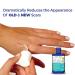ScarClear Triple Action Scar Treatment .5oz - Effective Scar Removal Solution - Buy Online on GoSupps.com