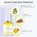 AIJIMEI 4-in-1 Professional Nail Kit: Cuticle Remover Gel Calcium Primer Nail Hardener & Strengthener Base & Top Coat Cuticle Oil - Ultimate Nail Care Solution - Buy Online on GoSupps.com