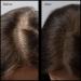 Hair Root Touch Up Powder - Medium Brown | 11 True-to-Nature Shades | Long-Lasting Fragrance-Free & Talc-Free Hair Concealer with Brush - Buy Online on GoSupps.com